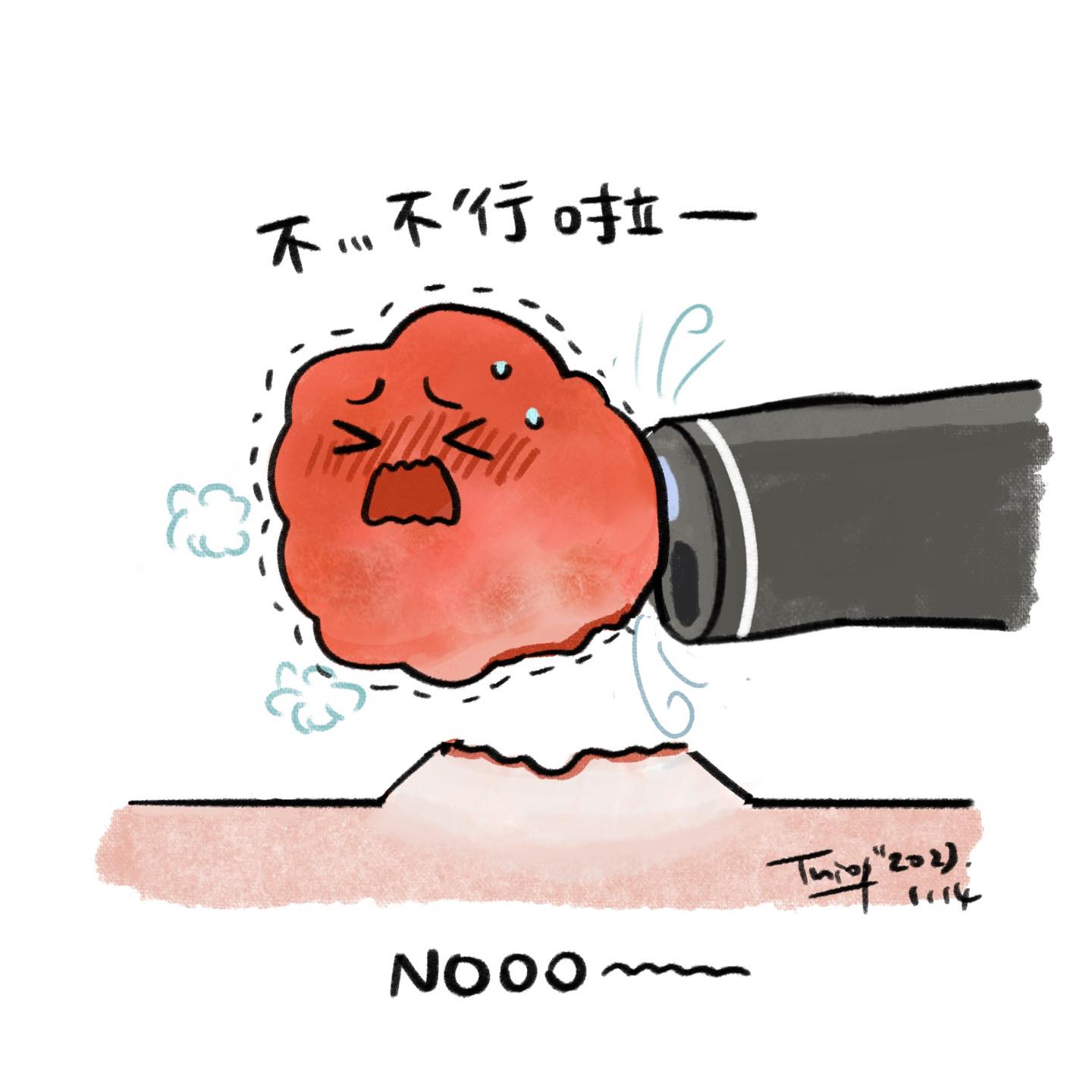 大腸息肉切除 EMR 圖解 7